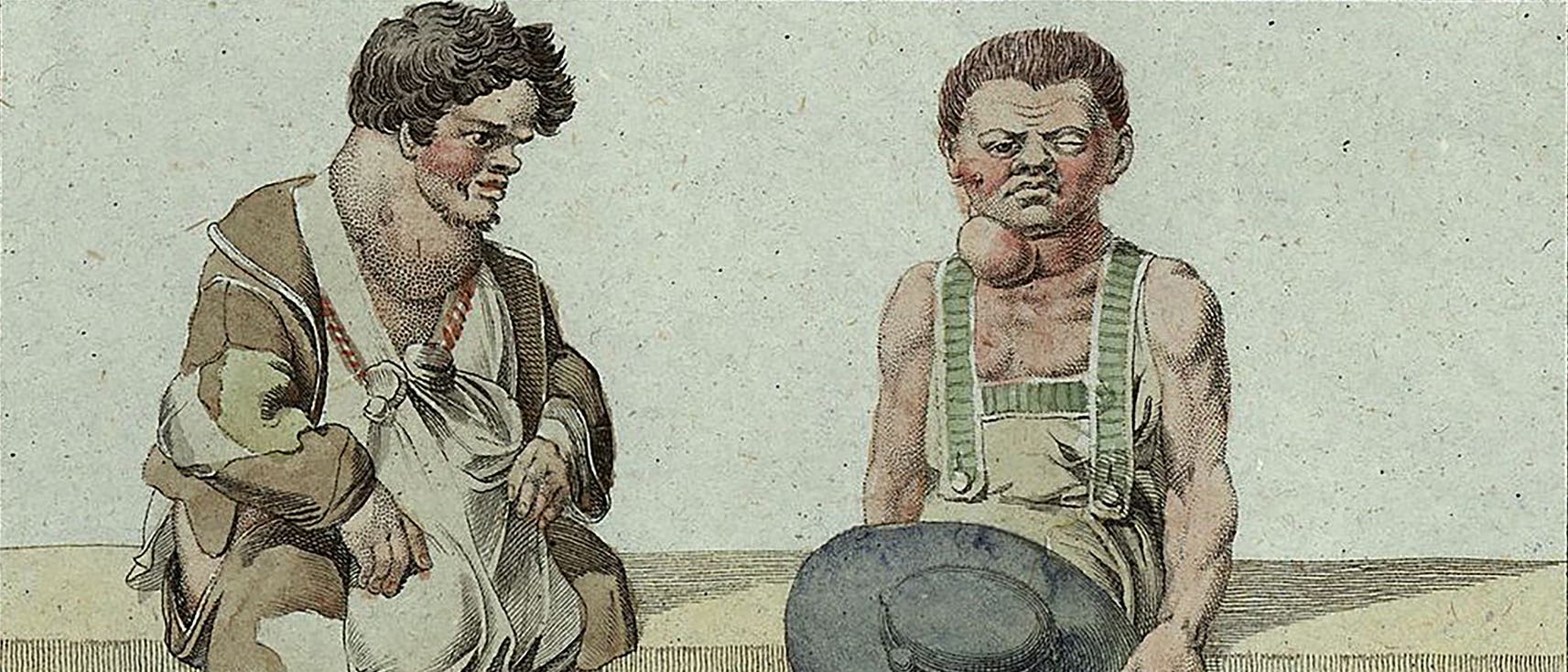 Men with goiters from Styria.  Drawing from 1819.