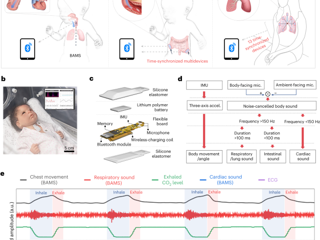Wireless broadband acoustic-mechanical sensing system for continuous physiological monitoring